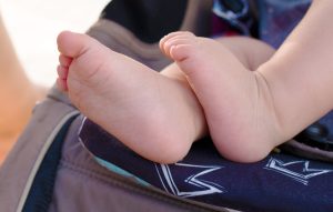 bebe are pielea uscata